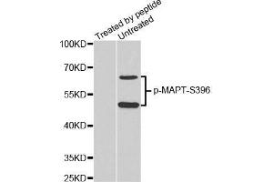 Western Blotting (WB) image for anti-Microtubule-Associated Protein tau (MAPT) (pSer396) antibody (ABIN3019683)