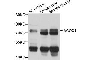 Western blot analysis of extracts of various cell lines, using ACOX1 antibody. (ACOX1 anticorps)