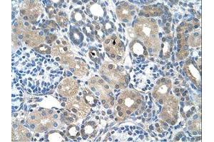 anti-F-Box Protein 25 (FBXO25) (C-Term) antibody