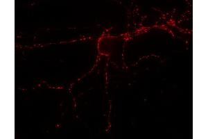 Indirect immunolabeling of PFA fixed cultured rat hippocampus neurons (dilution 1 : 500)