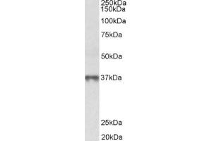Western Blotting (WB) image for anti-Methionine Adenosyltransferase II, beta (MAT2B) (Isoform 1), (N-Term) antibody (ABIN2465101) (MAT2B anticorps  (Isoform 1, N-Term))