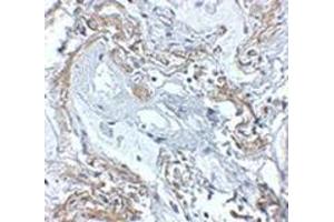 Immunohistochemistry of TNFAIP3 in human lung tissue with this product at 5 μg/ml.