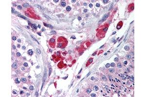 Anti-HIPK3 antibody IHC of human testis. (HIPK3 anticorps  (AA 850-900))