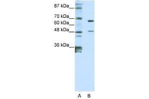 Western Blot showing ZNF597 antibody used at a concentration of 1-2 ug/ml to detect its target protein. (ZNF597 anticorps  (N-Term))