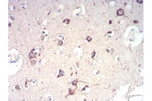 Immunohistochemical analysis of paraffin-embedded brain tissues using NFKBIA mouse mAb with DAB staining. (NFKBIA anticorps  (AA 150-291))