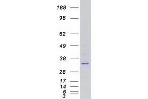 Validation with Western Blot