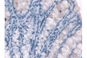 Detection of HBa1 in Mouse Colon Tissue using Polyclonal Antibody to Hemoglobin Alpha 1 (HBa1)