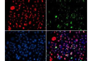 Immunofluorescence analysis of GFP-RNF168 transgenic U2OS cells using Phospho-SMC1A-S957 antibody. (SMC1A anticorps  (pSer957))