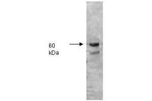 Image no. 1 for anti-Intestinal Alkaline Phosphatase (ALPI) antibody (ABIN799740) (Intestinal Alkaline Phosphatase anticorps)