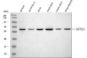 Western blot analysis of SETD3 using anti-SETD3 antibody (ABIN7600293). (SETD3 anticorps  (AA 173-468))