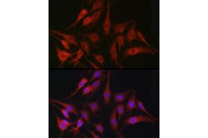 Immunofluorescence analysis of C6 cells using [KO Validated] Fascin/Fascin/FSCN1 Rabbit pAb (ABIN3023681, ABIN3023682, ABIN3023683, ABIN1679910 and ABIN1679911) at dilution of 1:100 (40x lens).