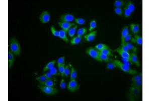 Immunofluorescence staining of HepG2 cells with ABIN7164570 at 1:200, counter-stained with DAPI. (ZDHHC14 anticorps  (AA 328-453))