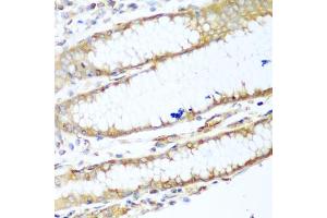 Immunohistochemistry of paraffin-embedded human stomach using MYH9 antibody. (Myosin 9 anticorps)