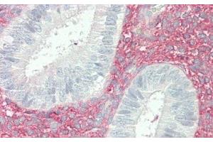 Detection of VCAN in Human Uterus Tissue using Polyclonal Antibody to Versican (VCAN)