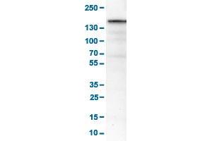 Western Blot analysis of RT-4 cell lysates with MKL2 monoclonal antibody, clone CL1546 . (MKL2 anticorps  (AA 136-273))