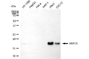 Western blotting analysis using ARPC5 antibody (ABIN7797454).