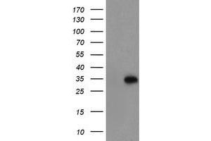 Western Blotting (WB) image for anti-Myeloid Leukemia Factor 1 (MLF1) antibody (ABIN1499498) (MLF1 anticorps)