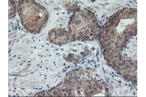 Image no. 3 for anti-Regulatory Factor X-Associated Ankyrin Containing Protein (RFXANK) antibody (ABIN1500685)