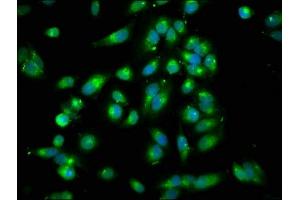 Immunofluorescence staining of Hela cells with ABIN7167994 at 1:250, counter-stained with DAPI. (ARHGEF7 anticorps  (AA 1-250))