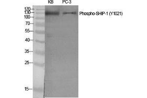 Western Blot (WB) analysis of specific cells using Phospho-SHIP-1 (Y1021) Polyclonal Antibody. (INPP5D anticorps  (pTyr1021))
