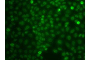 Immunofluorescence analysis of A549 cell using CBLC antibody. (CBLC anticorps)