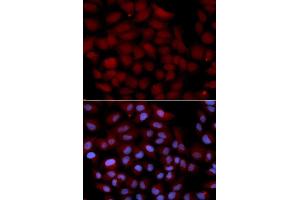 Immunofluorescence analysis of U2OS cell using TNK2 antibody. (TNK2 anticorps  (AA 70-385))