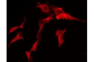 ABIN6275586 staining Hela by IF/ICC. (SLC28A2 anticorps  (Internal Region))