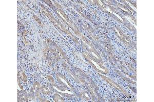 IHC analysis of Grp75 using anti-Grp75 antibody (ABIN7602782). (HSPA9 anticorps  (C-Term))