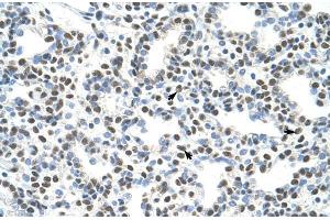 Human Lung; AKAP8L antibody - C-terminal region in Human Lung cells using Immunohistochemistry (AKAP8L anticorps  (C-Term))