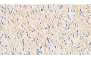 Detection of Hsp60 in Human Cardiac Muscle Tissue using Polyclonal Antibody to Heat Shock Protein 60 (Hsp60)