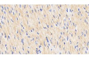 Detection of Hsp60 in Human Cardiac Muscle Tissue using Polyclonal Antibody to Heat Shock Protein 60 (Hsp60) (HSPD1 anticorps  (AA 1-573))