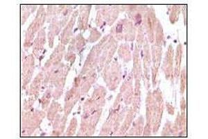 Immunohistochemical analysis of paraffin-embedded human normal cardiac muscle tissue, showing cytoplasmic localization using cTnI mouse mAb with DAB staining. (TNNI3 anticorps)