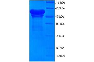 SDS-PAGE (SDS) image for Leucine Rich Repeat and Ig Domain Containing 1 (LINGO1) (AA 37-555) protein (His tag) (ABIN5714490)