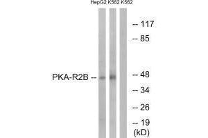 Western blot analysis of extracts from HepG2 cells and K562 cells, using PKA-R2β (Ab-113) antibody.