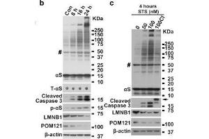 Apoptosis induces αS aggregation and phosphorylation in BE(2)-M17D/3D5 cells.