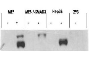 Western blot using SMAD3 (phospho S423/425) polyclonal antibody  shows detection of endogenous SMAD3 in stimulated cell lysates. (SMAD3 anticorps  (pSer423, pSer425))