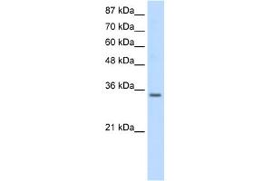 WB Suggested Anti-SNRPA Antibody Titration:  0. (SNRPA1 anticorps  (Middle Region))
