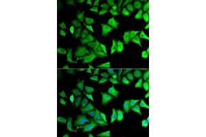 Immunofluorescence analysis of MCF-7 cells using RPS12 antibody.