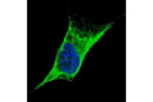 Fluorescent confocal image of SY5Y cells stained with Vimentin (C-term) antibody. (Vimentin anticorps  (C-Term))