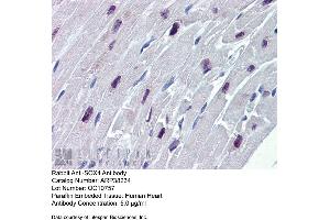 Immunohistochemistry (IHC) image for anti-SRY (Sex Determining Region Y)-Box 4 (SOX4) (N-Term) antibody (ABIN2780469)