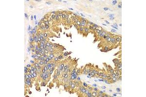 Immunohistochemistry of paraffin-embedded human prostate using DDX58 antibody.