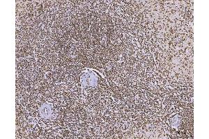 IHC analysis of C1orf77/FOP/CHTOP using anti-C1orf77/FOP/CHTOP antibody (ABIN7603201). (CHTOP anticorps  (N-Term))