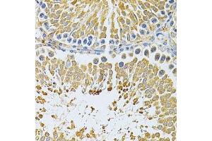 Immunohistochemistry of paraffin-embedded rat testis using PIBF1 Antibody. (PIBF1 anticorps)