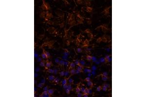 Immunofluorescence analysis of C6 cells using NC / CD56 antibody (ABIN6127607, ABIN6144393, ABIN6144395 and ABIN6223907) at dilution of 1:100. (CD56 anticorps  (AA 759-858))