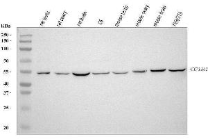 Western blot analysis of Aromatase/Cyp19a1 using anti-Aromatase/Cyp19a1 antibody (ABIN7602417).