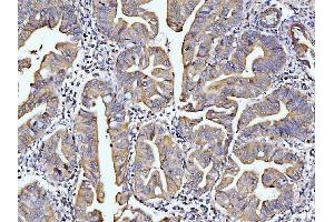 IHC analysis of DUSP6 using anti-DUSP6 antibody (ABIN7599332). (DUSP6 anticorps  (AA 1-381))