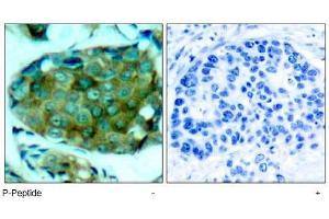 Image no. 1 for anti-Mechanistic Target of Rapamycin (serine/threonine Kinase) (mTOR) (pSer2448) antibody (ABIN196962) (MTOR anticorps  (pSer2448))
