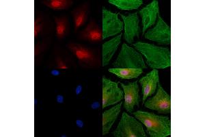 ABIN6264131 and ABIN6277486 staining  cells by IF/ICC. (PELP1 anticorps  (Internal Region))