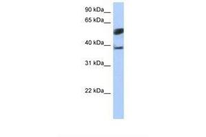 Image no. 1 for anti-Speckle-Type POZ Protein-Like (SPOPL) (AA 74-123) antibody (ABIN6739277) (SPOPL anticorps  (AA 74-123))