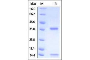 Biotinylated Human FcRn / FCGRT & B2M on SDS-PAGE under reducing (R) condition.